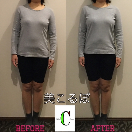 美こるぽのブログ お客様before After 3